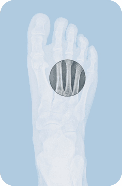 Medical imaging of feet