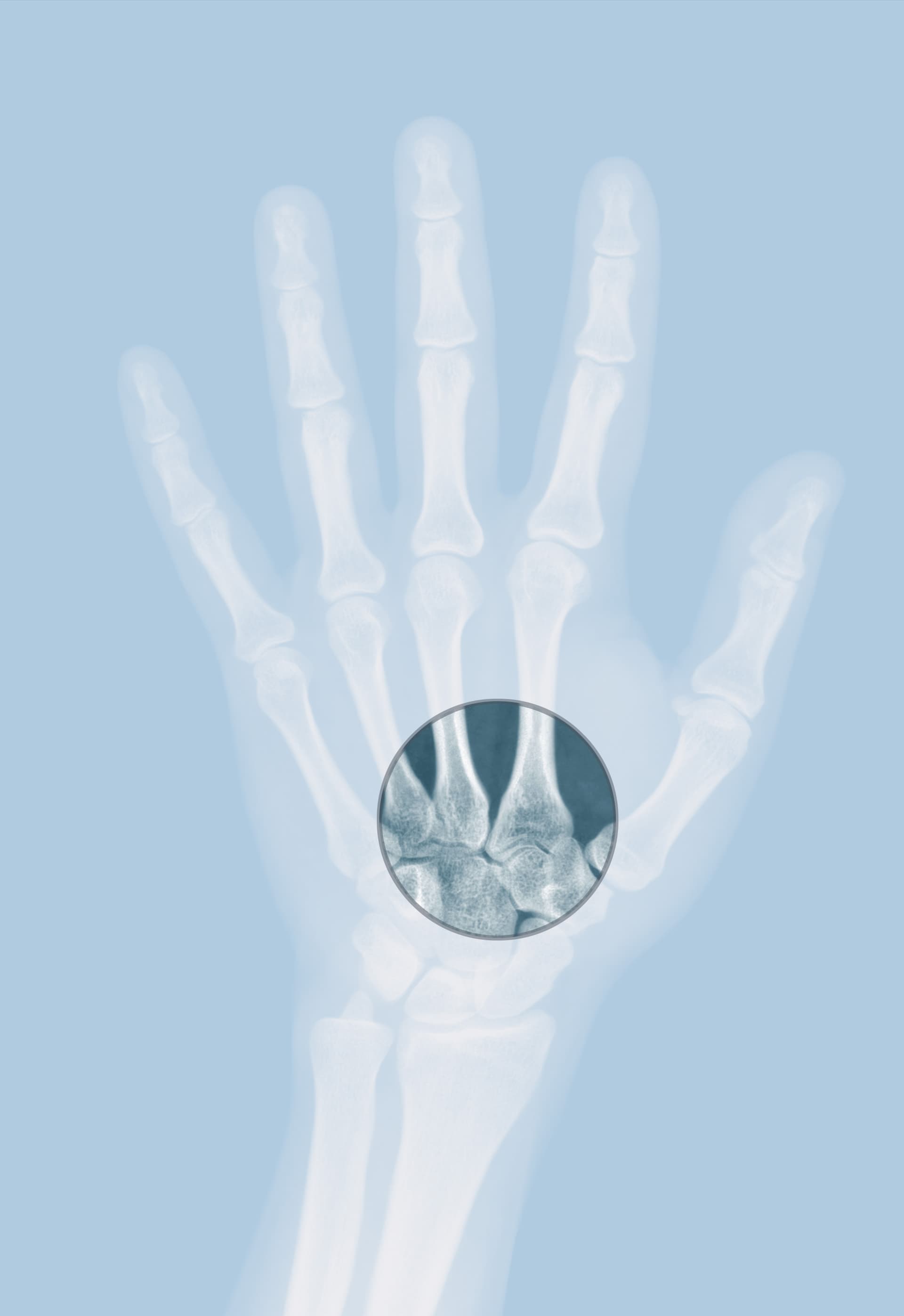 Radiological scan