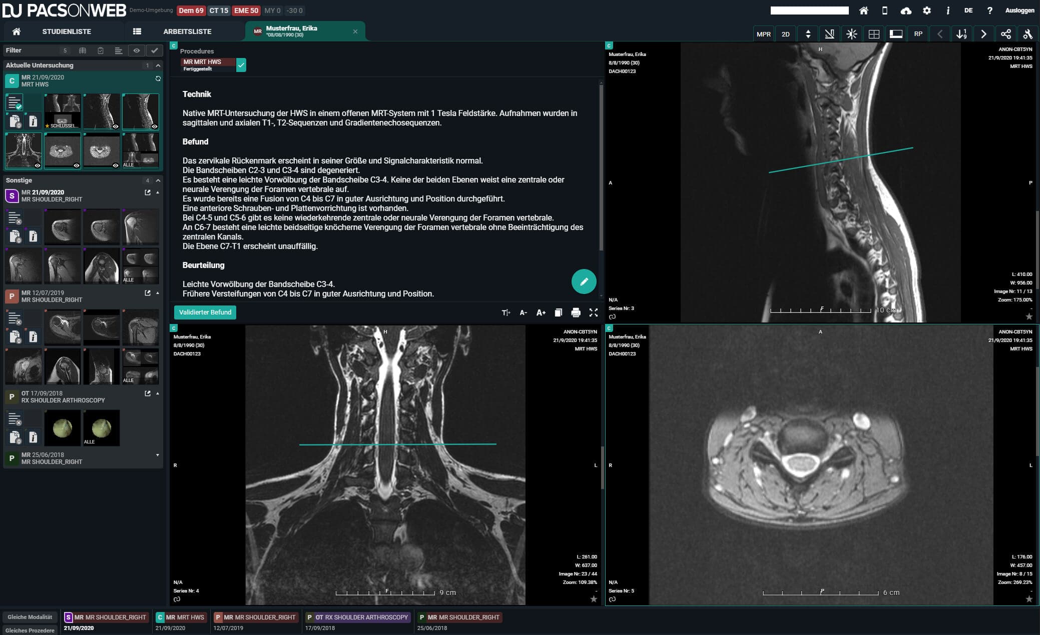 RadiologyCheck atteint 24+ pays et 218+ dossiers