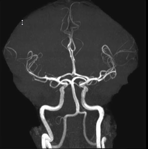 血管神经放射学