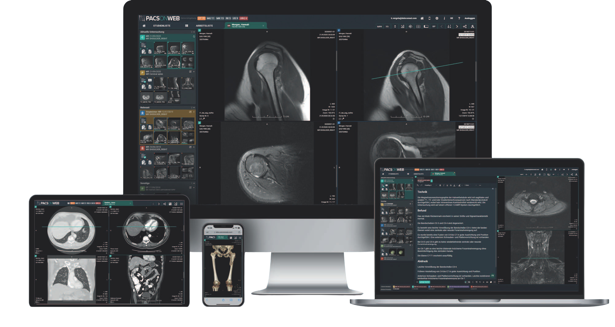 PACSonWEB platform on multiple devices
