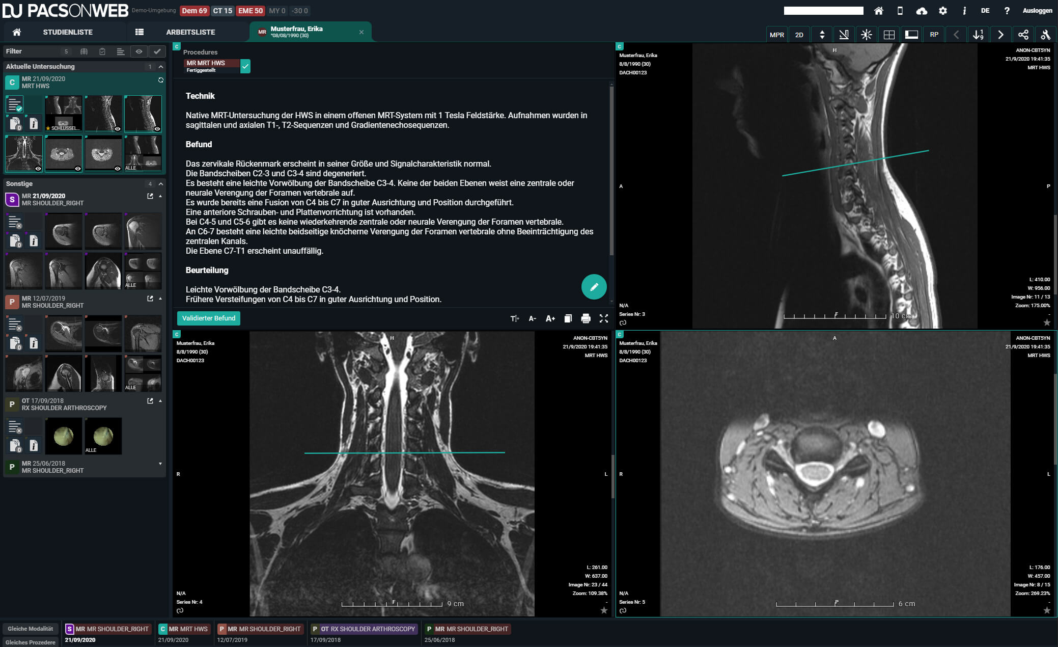 PACSonWEB viewer with patient study, multi-window layout and reporting
